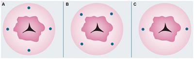 Recent management of endometrial cancer: a narrative review of the literature